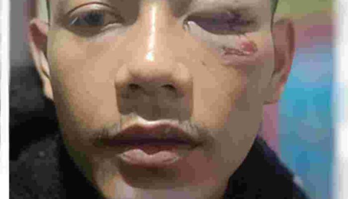 Robi Gunawan Menjadi Korban Penganiayaan Brutal, Pelaku Harus Secepatnya Diproses Hukum