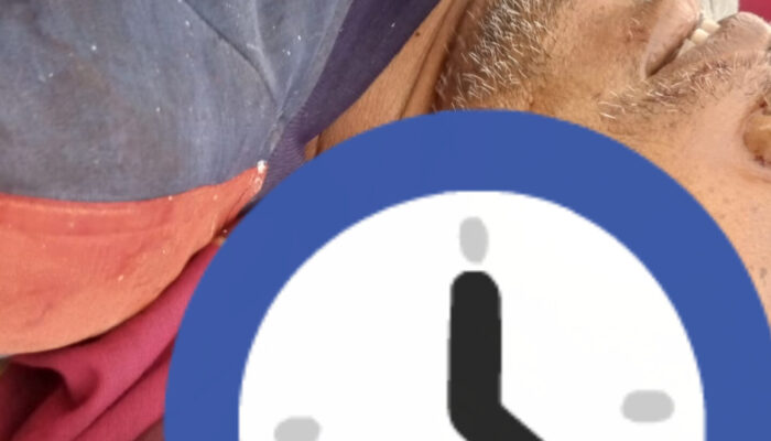 Firasat Sebelum Meninggal, Korban Samari Diduga Dibunuh – Keluarga Laporkan ke Polisi